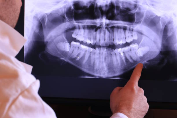 Best Emergency Broken Tooth Repair in Stoneville, NC