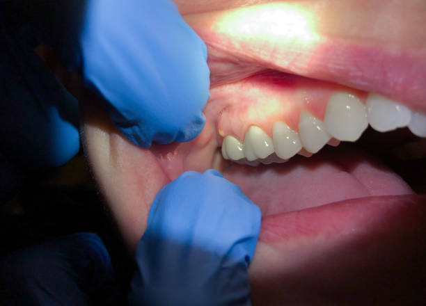 Best Emergency Treatment for Toothache in Stoneville, NC