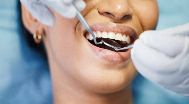 Best Emergency Tooth Extraction in Stoneville, NC