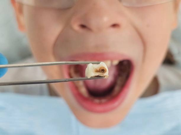 Best Same-Day Emergency Dentist in Stoneville, NC